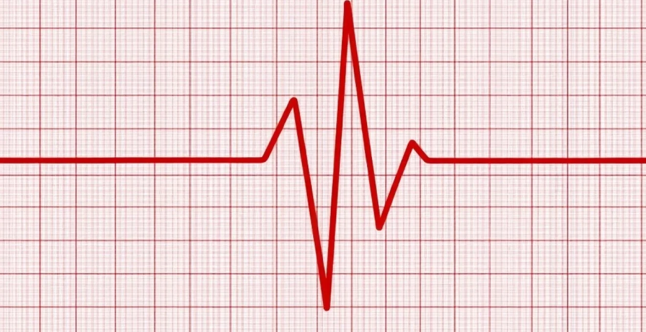 what-an-abnormal-ecg-means