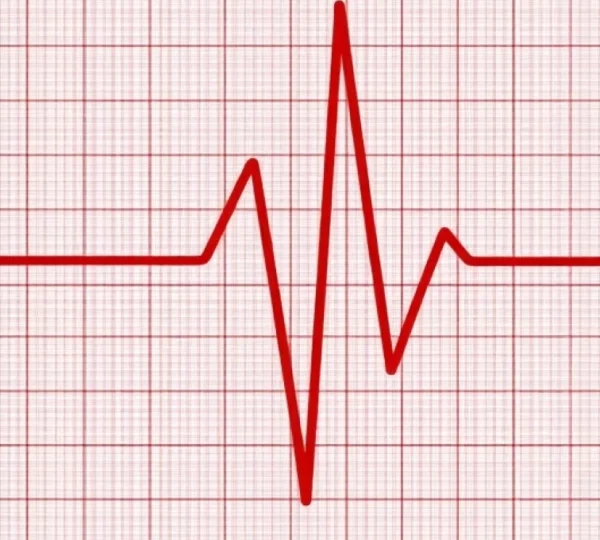 what-an-abnormal-ecg-means