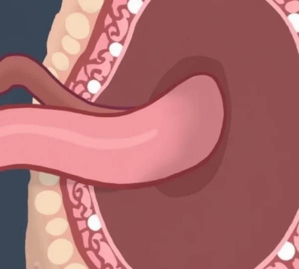 what-lymphocele-lumps-look-like